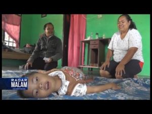Bocah Lumpuh Otak, BPJS Putuskan Pemkab