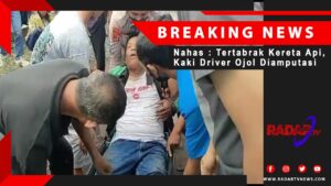 Nahas, Tertabrak Kereta Api, Kaki Driver Ojol Diamputasi